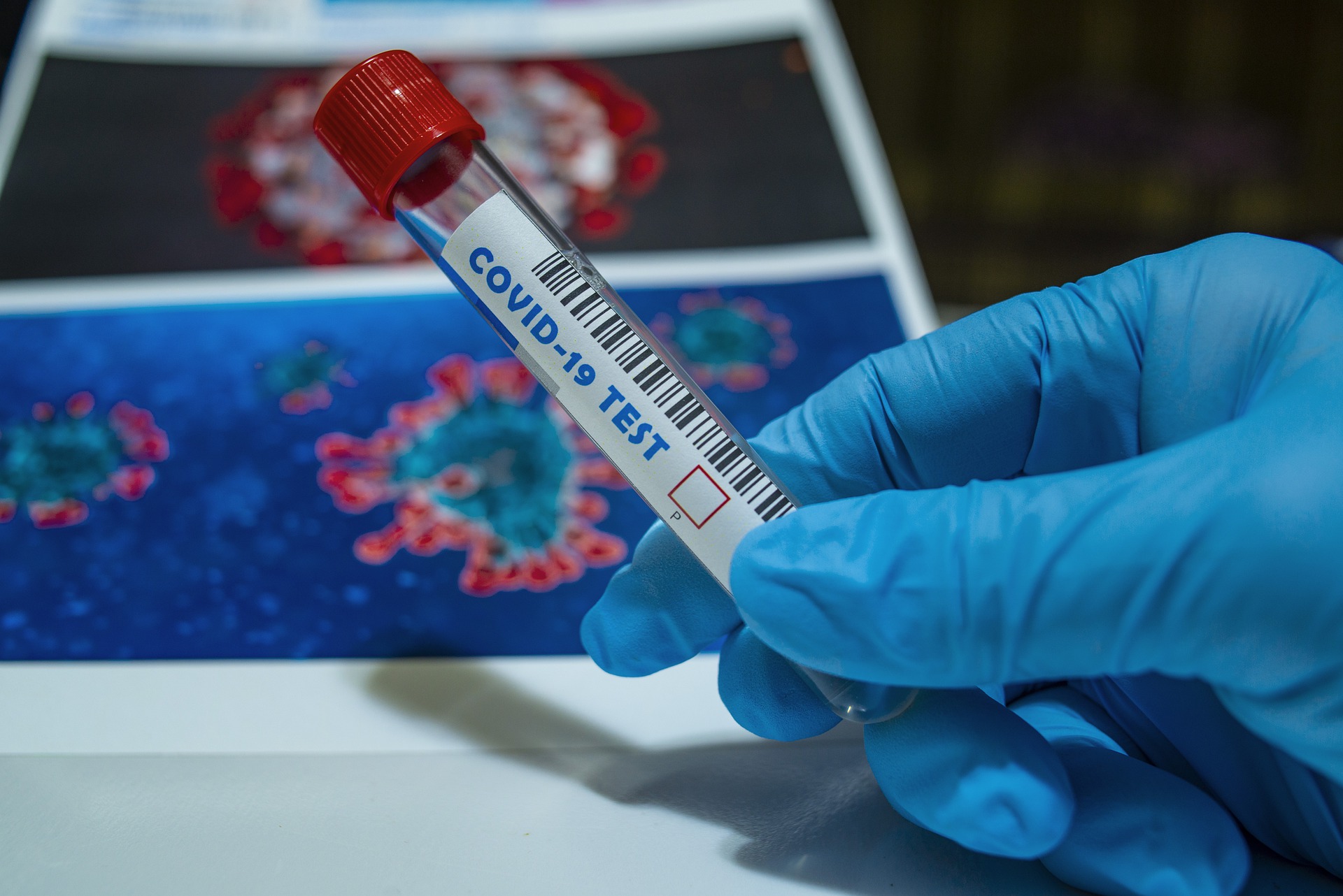 Reportáž s Vojtěchem Veltruským z EUC Laboratoří o odběrech na COVID-19