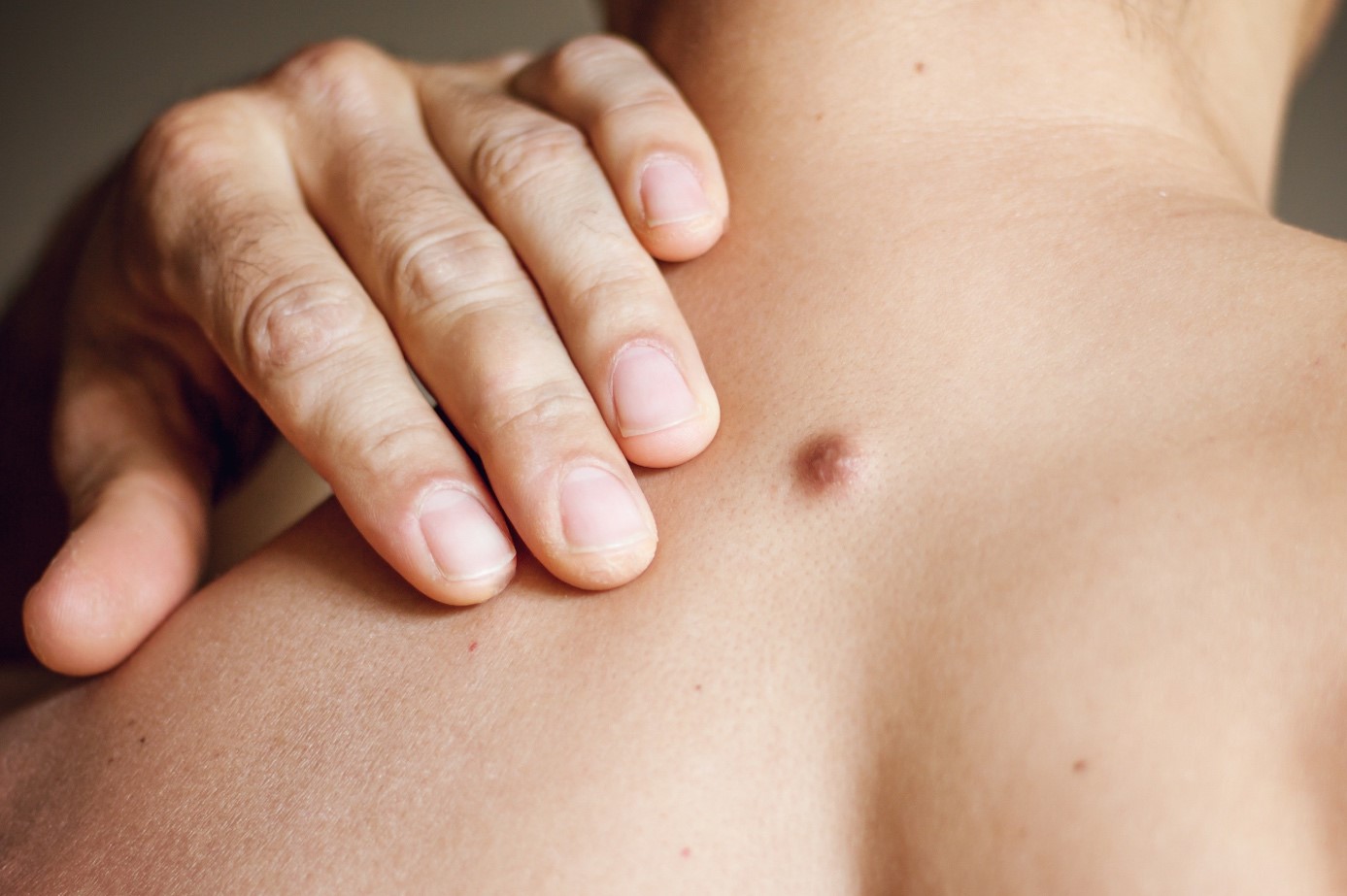 Fibrom: Druhy, příznaky a léčba
