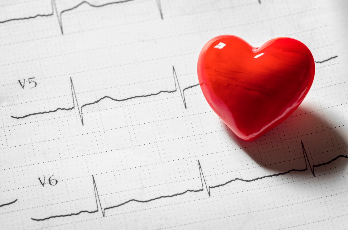 Čechy trápí vysoký cholesterol – nebolí, ale může zabíjet